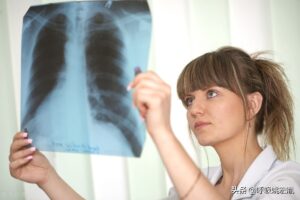 肺结节是什么原因_肺部结节形成的原因