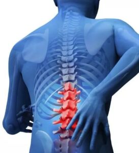急性腰扭伤是什么_如何预防急性腰扭伤