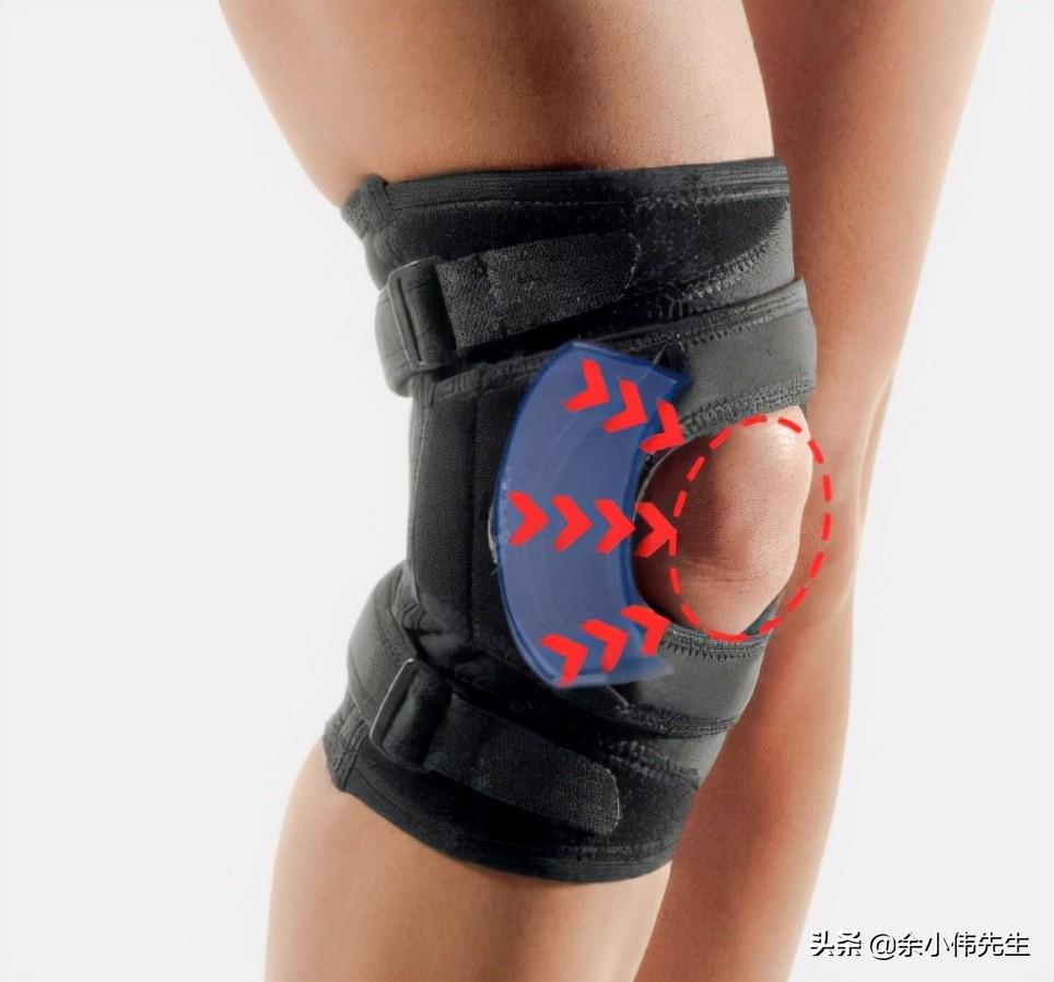 护膝有哪几类_护膝类型和作用